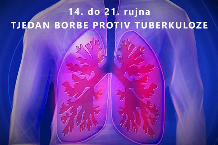 Slika: Tjedan borbe protiv tuberkuloze od 14. do 21. rujna 2025. godine