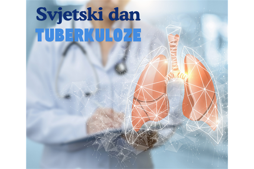 Slika: Tuberkuloza je i dalje dio naše stvarnosti
